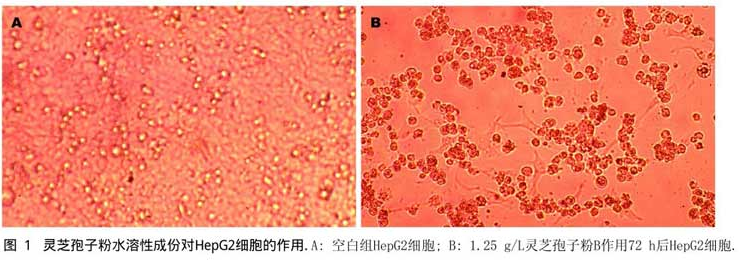 灵芝孢子粉对人肝癌细胞HepG2及裸鼠移植瘤生长的抑制作用