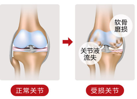 维骨力怎么吃好呢？