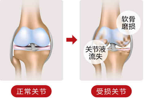 哪些人不能服用氨糖维骨力呢？